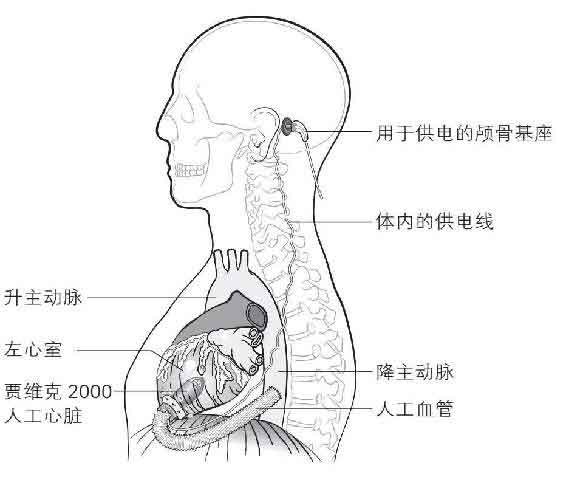 打开一颗心