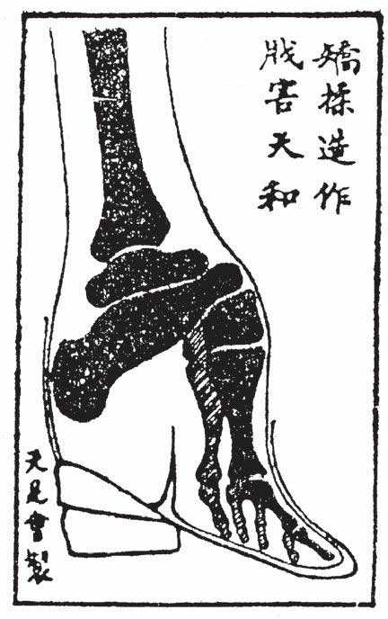 好嘴杨巴