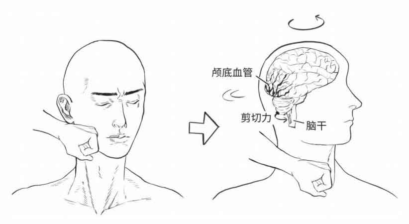 超正经凶案调查