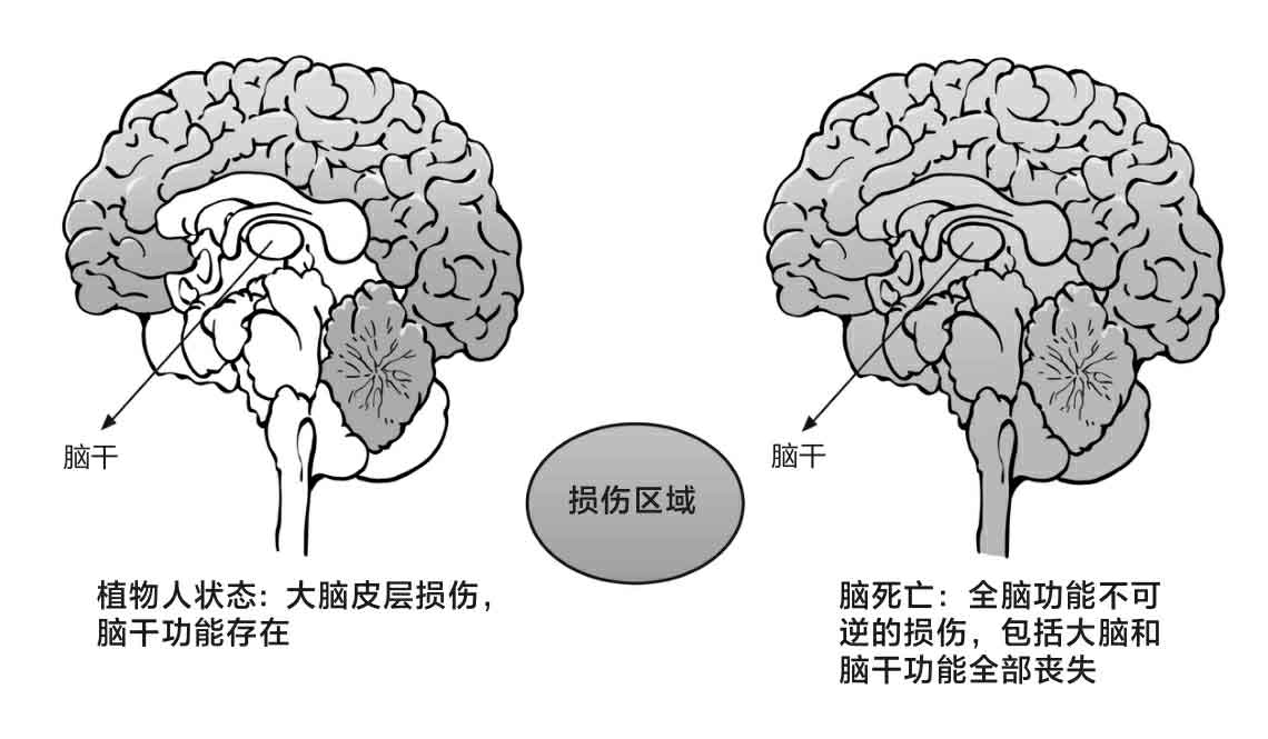 命悬一线我不放手