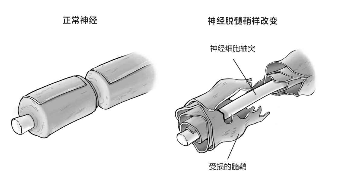 命悬一线我不放手